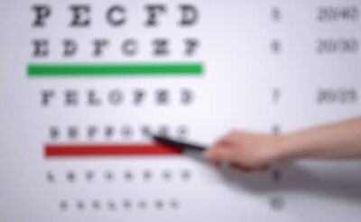 Mắt nhìn mờ có phải bị cận thị không? 1 số dấu hiệu cận thị