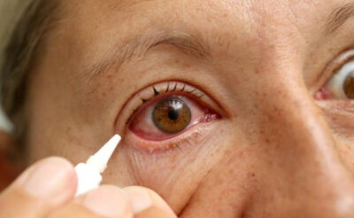 Liệu Atropine có phải là thuốc nhỏ mắt đục dịch kính hiệu quả? 
