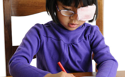 Nguy cơ bệnh nhược thị ở trẻ em như thế nào