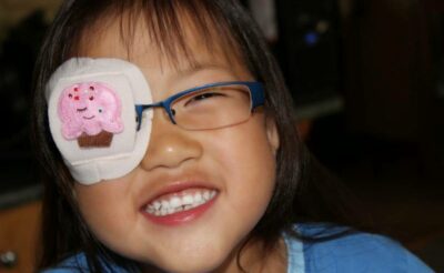 Nhược thị ở trẻ em: Khi nào nên phẫu thuật?