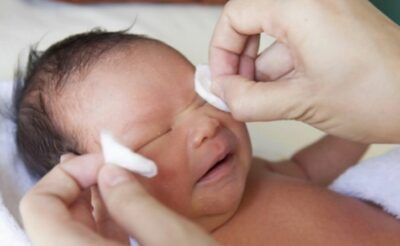 3 Cách phát hiện sớm viêm tắc lệ đạo ở trẻ sơ sinh