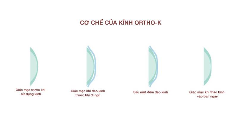 Cơ chế hoạt động của kính Ortho-K