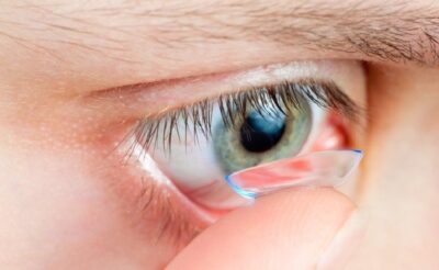 Trẻ bị nhược thị do viễn loạn điều trị thế nào?